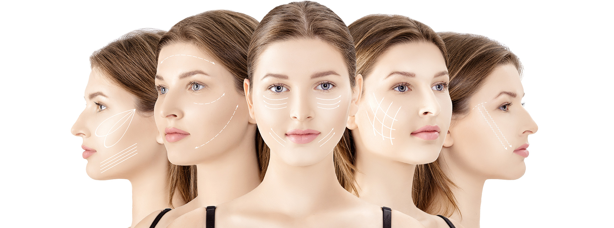 Best-Dermal-Fillers-Experts-in-Toronto