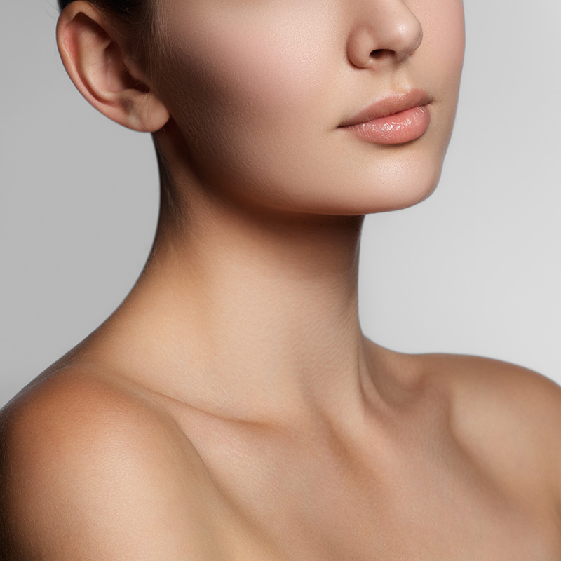 contour cheeks with filler